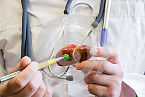 Doctor in white medical lab coat points ballpoint pen on anatomical model of human or animal gallbladder. Concept photo for use fo