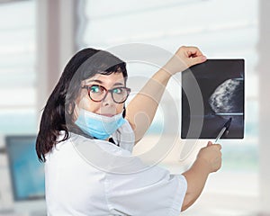 Doctor in white uniform and blue mask demonstrates x-ray image of female breast