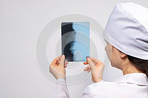 A doctor in white uniform examines an X-ray of a patient with a broken nose bone. Nose injury, crack or fracture - radiology and