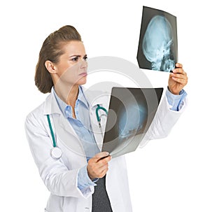 Doctor woman checking fluorography