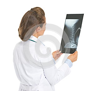 Doctor woman checking fluorography . rear view