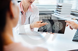 Doctor woman discussing x-ray with a patient couple