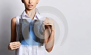 Doctor woman hold lungs X-ray examination of patient chest on gray