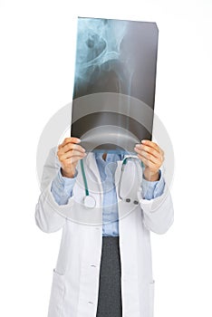 Doctor woman holding fluorography in front of face