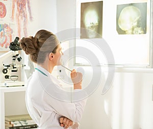 Doctor woman looking on fluorography on lightbox