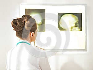 Doctor woman looking on fluorography. rear view