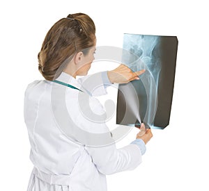 Doctor woman pointing on fluorography . rear view
