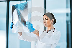 Doctor, woman and x ray for diagnosis in hospital, analysis and check results of patient MRI. Female person, research