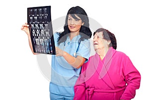 Doctor woman review MRI with her elderly patient