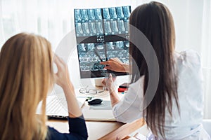 Doctor woman with white labcoat looking at x-ray