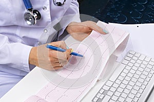 Doctor workplace. Electrocardiogram, ecg in hand of a female doctor with ekg graph paper in hospital office room with computer,