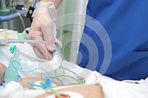 Doctor works with patient in the intensive care