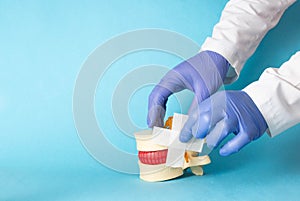 Doctor& x27;s hands glue a medical plaster on the mockup of the intervertebral disc, blue background. Spine Disease Therapy photo