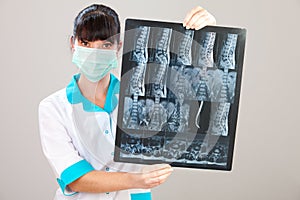 Doctor with xray
