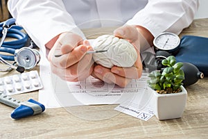 At doctors appointment physician shows to patient shape of brain with focus on hand with organ. Scene explaining patient causes an