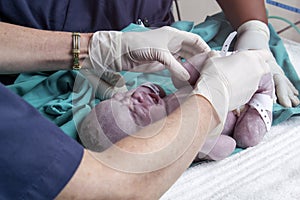 Doctors attending to a new born baby child