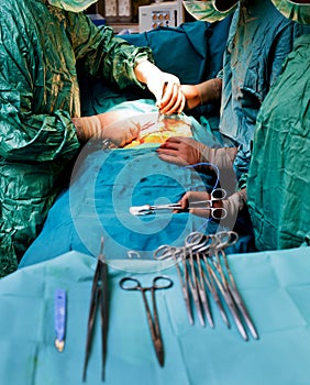 Doctors during cardiac surgery