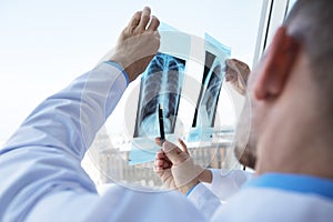 Doctors discuss and looking x-ray