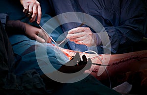 Doctors hands stitching patient leg