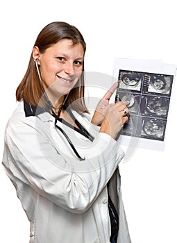 Doctors looking at echography photo