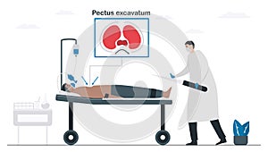 Doctors are operating a patient that is pectus excavatum. Pulmonology vector illustration about restrictive lung disease. Minimal
