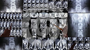 Doctors regard chest x-ray, collage. Multiscreen.