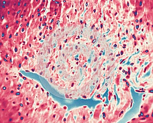 Dog cardiac muscle