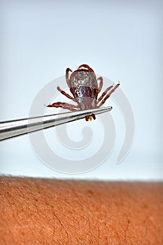 Dog Tick Removal photo