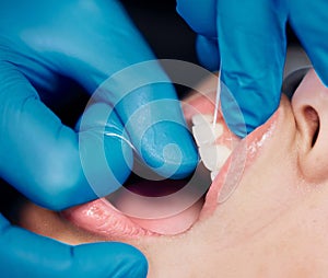 Doing it for them. Shot of a woman having her teeth flossed at the dentists office.