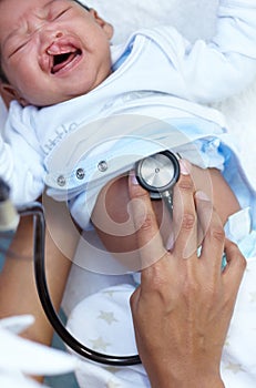 Doing a thorough examination. a baby girl with a cleft palate being examined by a doctor.