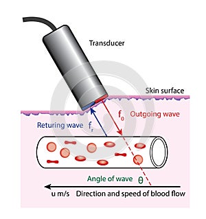Doppler blood flow measurement