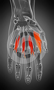 dorsal interosseous