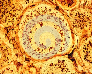 Dorsal root ganglion neurons. Golgi apparatus photo