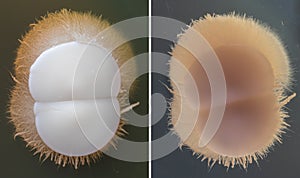 Colonies of Candida albicans that with the hyphae forming the mycelium, from yeast become filamentous fungus thanks to phenomena