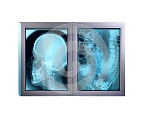 Double x-ray minitor,isolated photo