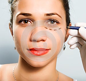 Drawing lines for facial plastic surgery