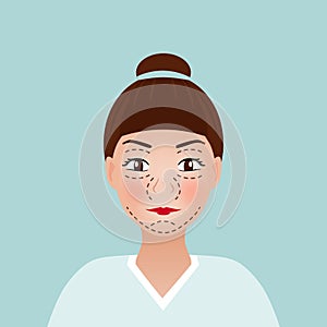 Drawing perforation lines on young pretty woman`s face for plastic surgery. vector illustration. medical face lift anti