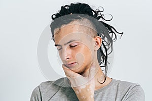 Dreadlocks man portrait. Closed eyes. Unusual people. Vitiligo