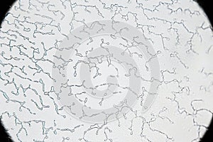 Dried human ejaculate texture under a light microscope, magnification 40 times, sperm cells are not