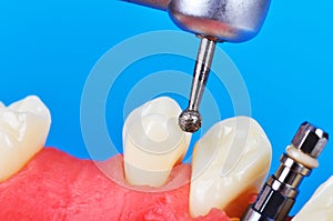 Drill and dental implant