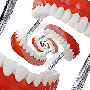 Droste Denture Model Cutout
