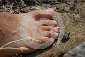 Dry cracked tanned skin of the foot, toes with flaky skin and nails with a sharp stone and thorns