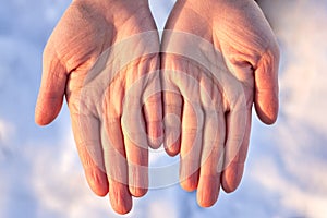 Dry female hands in winter on a background of snow