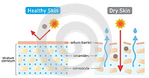 Dry and healthy skin layer. stratum corneum and ceramides. illustration. beauty and skin care concept