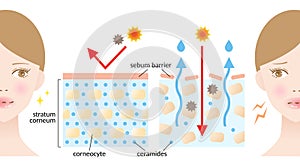 Dry and healthy skin layer and woman illustration. beauty and skin care concept