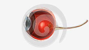 Dry Macular Degeneration 3d