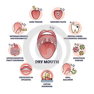Dry mouth or xerostomia as salivary glands saliva problem outline diagram photo