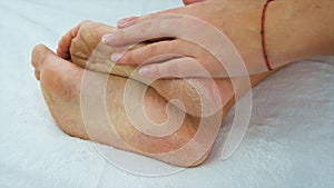 Dry skin of female feet. Selective focus.