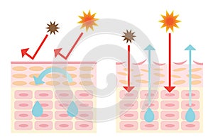 Dry skin and healthy skin