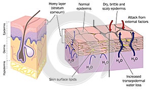 Dry skin photo